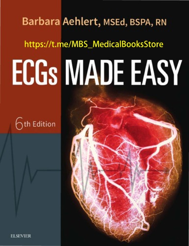 ECGs Made Easy - E-Book 2017