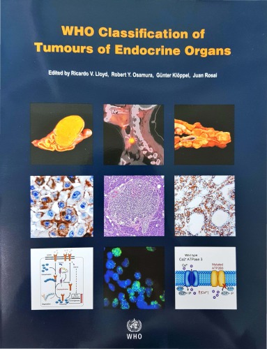 WHO Classification of Tumours of Endocrine Organs 2017
