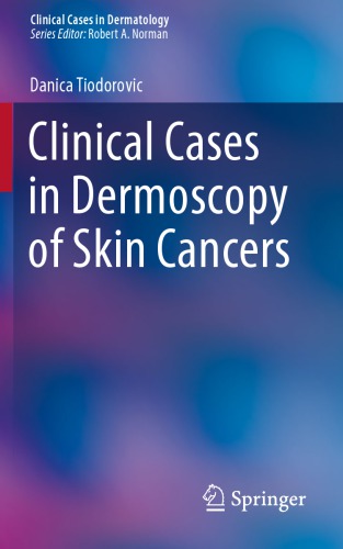Clinical Cases in Dermoscopy of Skin Cancers 2020