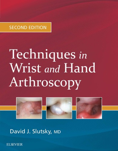 Techniques in Wrist and Hand Arthroscopy E-Book 2016