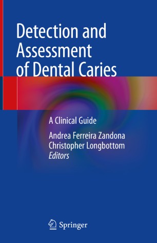 Detection and Assessment of Dental Caries: A Clinical Guide 2019