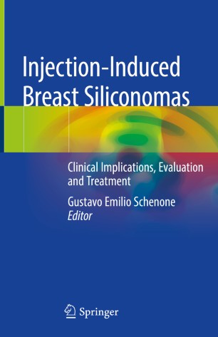 Injection-Induced Breast Siliconomas: Clinical Implications, Evaluation and Treatment 2019