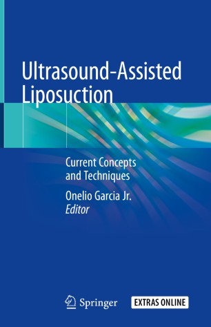 Ultrasound-Assisted Liposuction: Current Concepts and Techniques 2019
