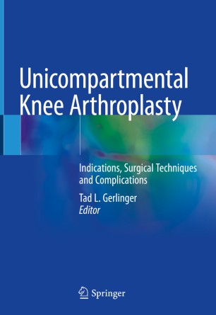 Unicompartmental Knee Arthroplasty: Indications, Surgical Techniques and Complications 2019