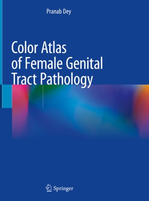 Color Atlas of Female Genital Tract Pathology 2018