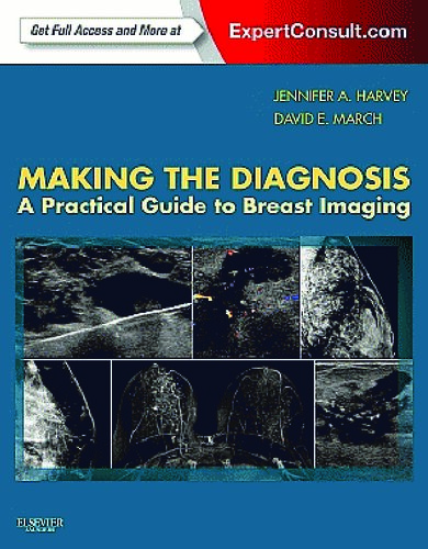 Making the Diagnosis: A Practical Guide to Breast Imaging 2013