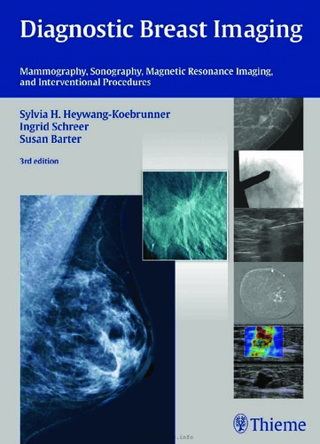 Diagnostic Breast Imaging: Mammography, Sonography, Magnetic Resonance Imaging, and Interventional Procedures 2014