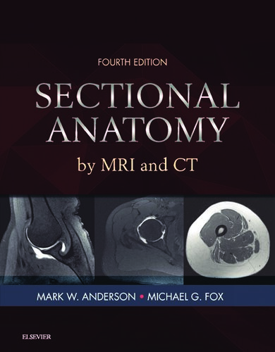 Sectional Anatomy by MRI and CT 2016