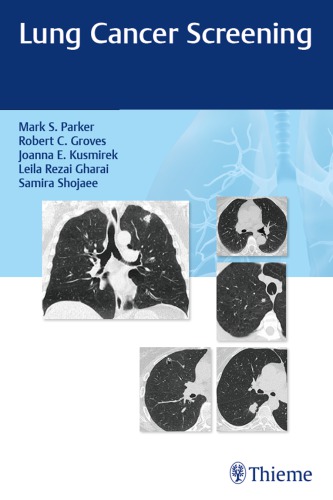 Lung Cancer Screening 2017