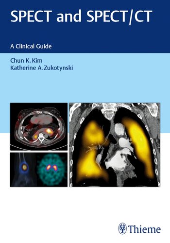 SPECT and SPECT/CT: A Clinical Guide 2017