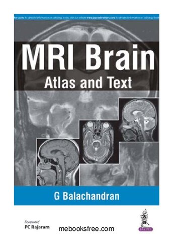MRI Brain: Atlas and Text 2015