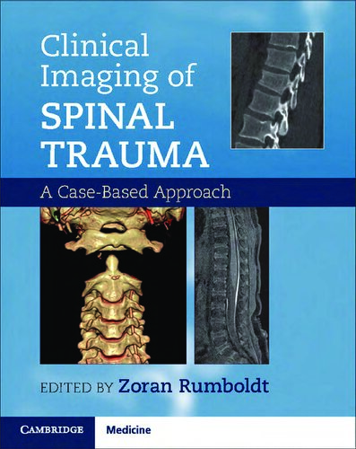 Clinical Imaging of Spinal Trauma: A Case-Based Approach 2018