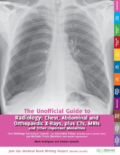 Unofficial Guide to Radiology: Chest, Abdominal and Orthopaedic X Rays, Plus CTs, MRIs and Other Important Modalities: Core Radiology Curriculum 2014