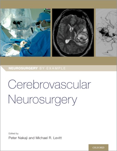 Cerebrovascular Neurosurgery 2019