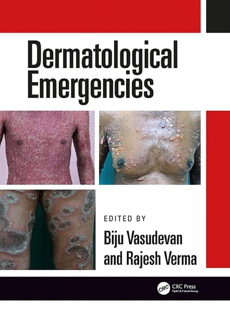 Dermatological Emergencies 2019