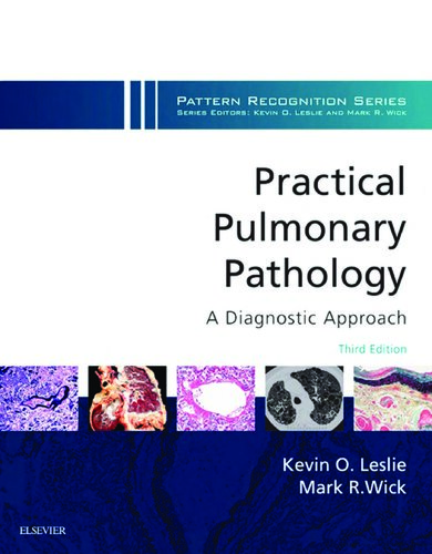 Practical Pulmonary Pathology: A Diagnostic Approach 2017