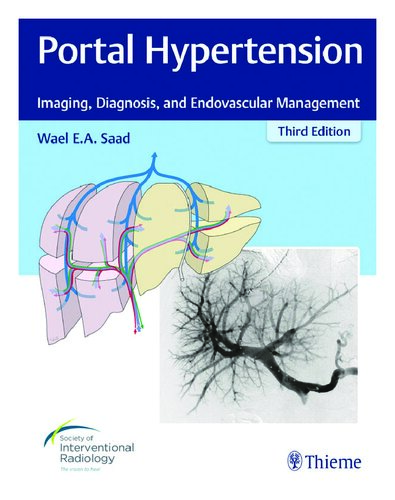 Portal Hypertension: Imaging, Diagnosis, and Endovascular Management 2017