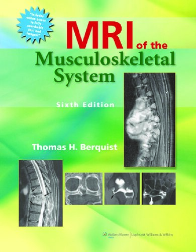 MRI of the Musculoskeletal System 2012