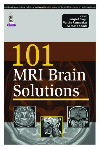 ۱۰۱ راه حل ام آر آی مغز ۲۰۱۵