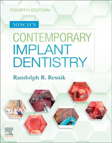 Misch's Contemporary Implant Dentistry 2019