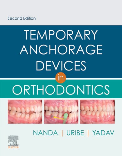 Temporary Anchorage Devices in Orthodontics 2020