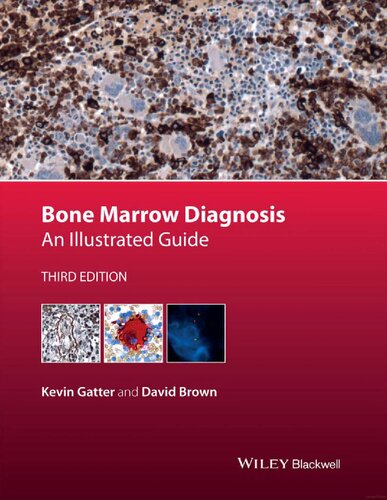 Bone Marrow Diagnosis: An Illustrated Guide 2014