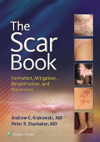 The Scar Book: Formation, Mitigation, Rehabilitation and Prevention 2017