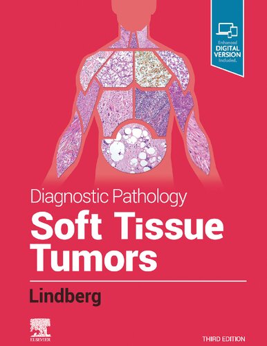 Diagnostic Pathology: Soft Tissue Tumors 2019