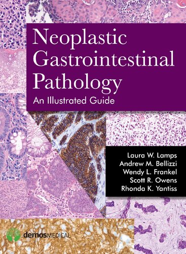 Neoplastic Gastrointestinal Pathology: An Illustrated Guide: An Illustrated Guide 2015