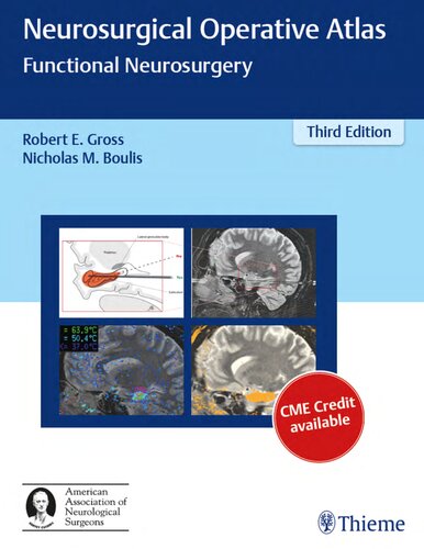 اطلس جراحی مغز و اعصاب: جراحی مغز و اعصاب عملکردی