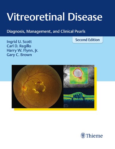 Vitreoretinal Disease: Diagnosis, Management, and Clinical Pearls 2017
