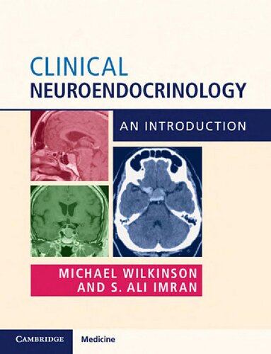 Clinical Neuroendocrinology: An Introduction 2019