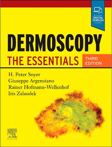 Dermoscopy: The Essentials 2020