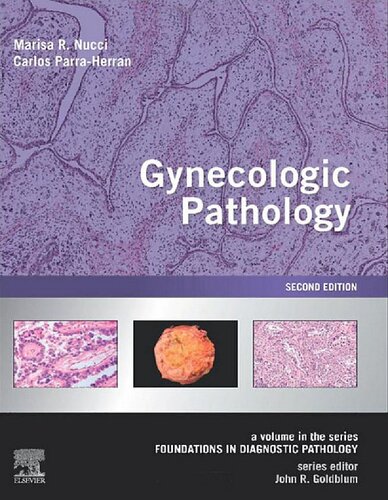 Gynecologic Pathology: A Volume in Foundations in Diagnostic Pathology Series 2020