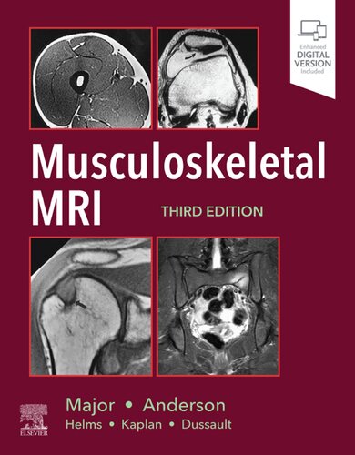 Musculoskeletal MRI 2019