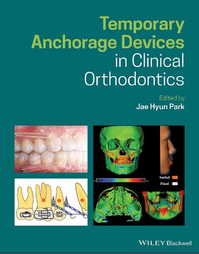 Temporary Anchorage Devices in Clinical Orthodontics 2020