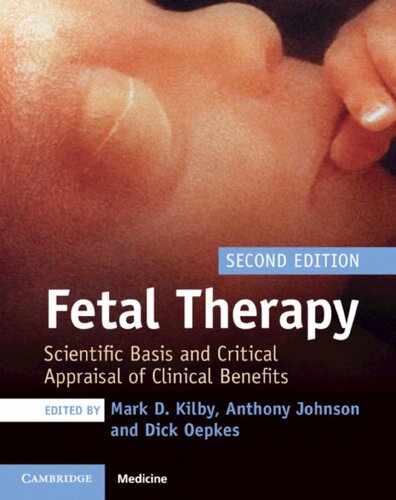 Fetal Therapy: Scientific Basis and Critical Appraisal of Clinical Benefits 2020