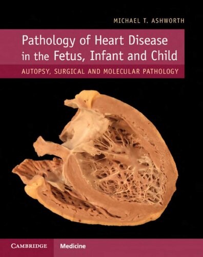 Pathology of Heart Disease in the Fetus, Infant and Child: Autopsy, Surgical and Molecular Pathology 2019