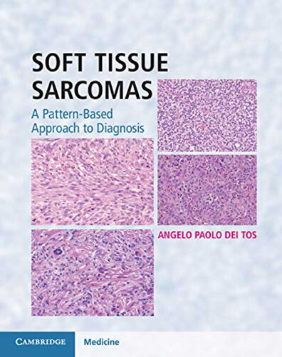 Soft Tissue Sarcomas 2018