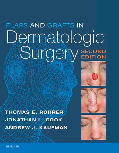 Flaps and Grafts in Dermatologic Surgery 2017