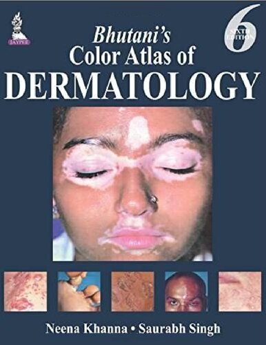 Bhutani’s Color Atlas of Dermatology 2015