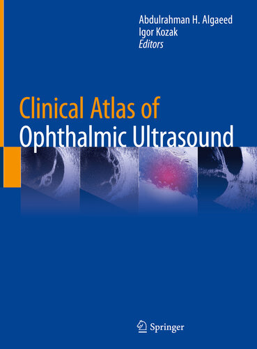 Clinical Atlas of Ophthalmic Ultrasound 2018