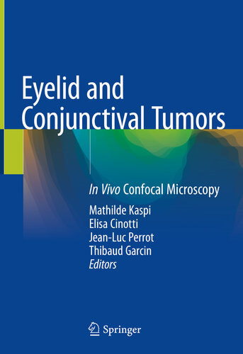 Eyelid and Conjunctival Tumors: In Vivo Confocal Microscopy 2020