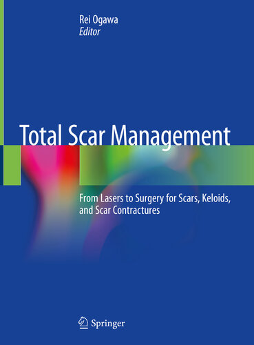 Total Scar Management: From Lasers to Surgery for Scars, Keloids, and Scar Contractures 2019