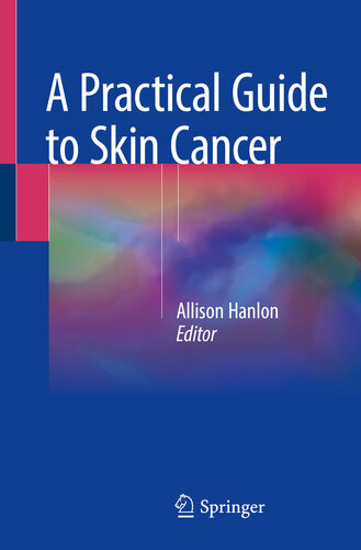A Practical Guide to Skin Cancer 2018