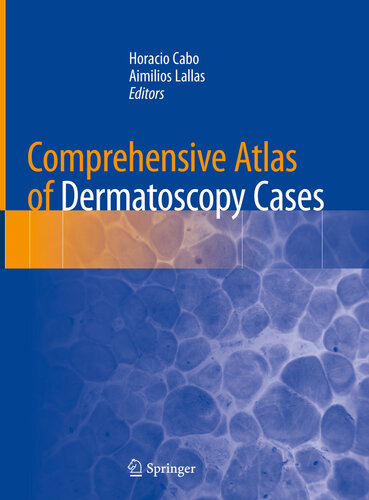 Comprehensive Atlas of Dermatoscopy Cases 2018