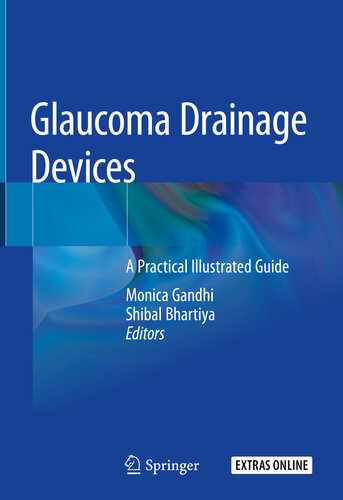 Glaucoma Drainage Devices: A Practical Illustrated Guide 2019
