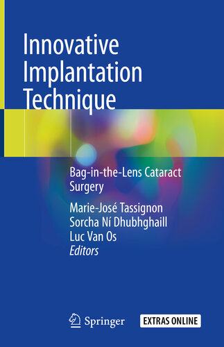 Innovative Implantation Technique: Bag-in-the-Lens Cataract Surgery 2019