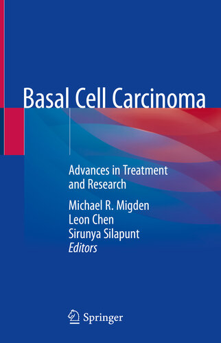 Basal Cell Carcinoma: Advances in Treatment and Research 2019