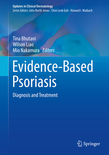 Evidence-Based Psoriasis: Diagnosis and Treatment 2018